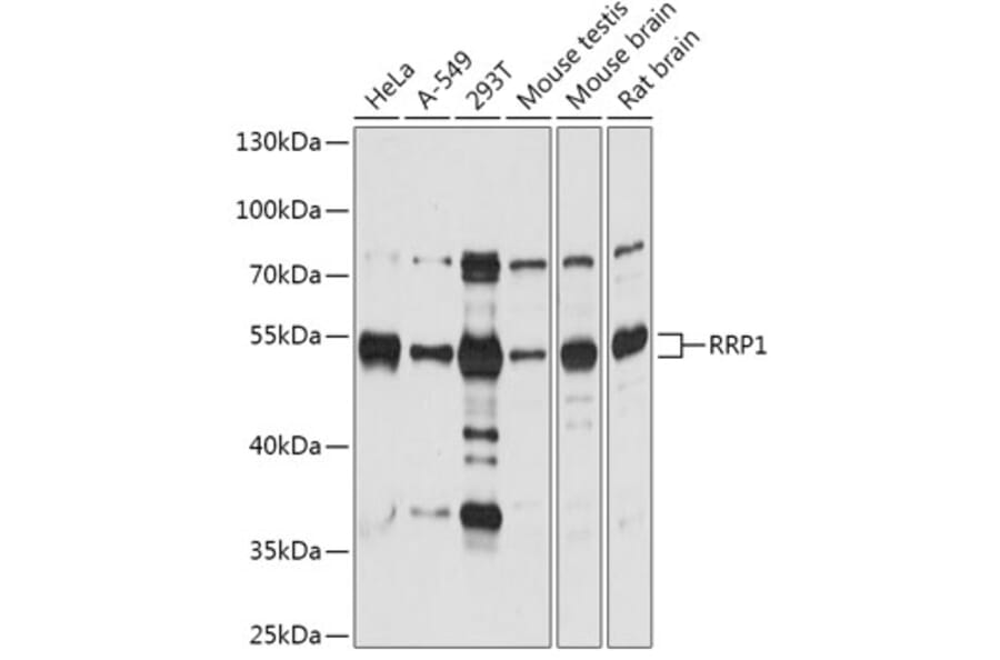 Western Blot - Anti-RRP1 Antibody (A305631) - Antibodies.com