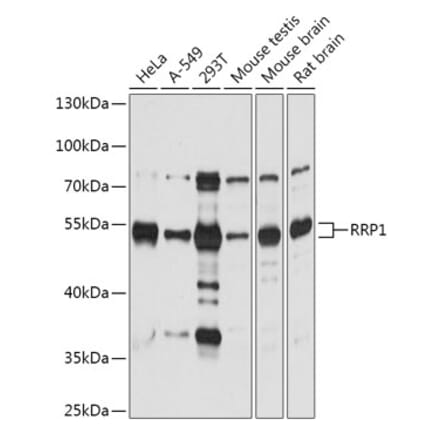 Western Blot - Anti-RRP1 Antibody (A305631) - Antibodies.com