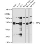 Western Blot - Anti-RRP1 Antibody (A305631) - Antibodies.com