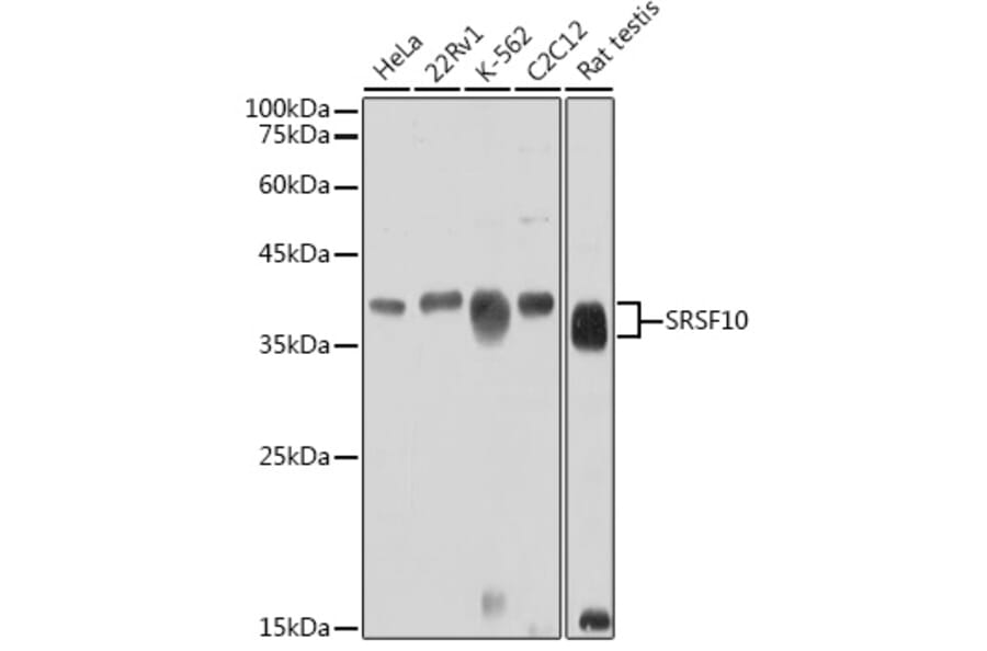 Western Blot - Anti-SRSF10 Antibody (A305632) - Antibodies.com