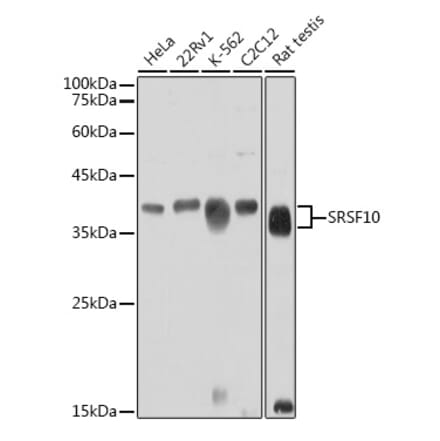 Western Blot - Anti-SRSF10 Antibody (A305632) - Antibodies.com