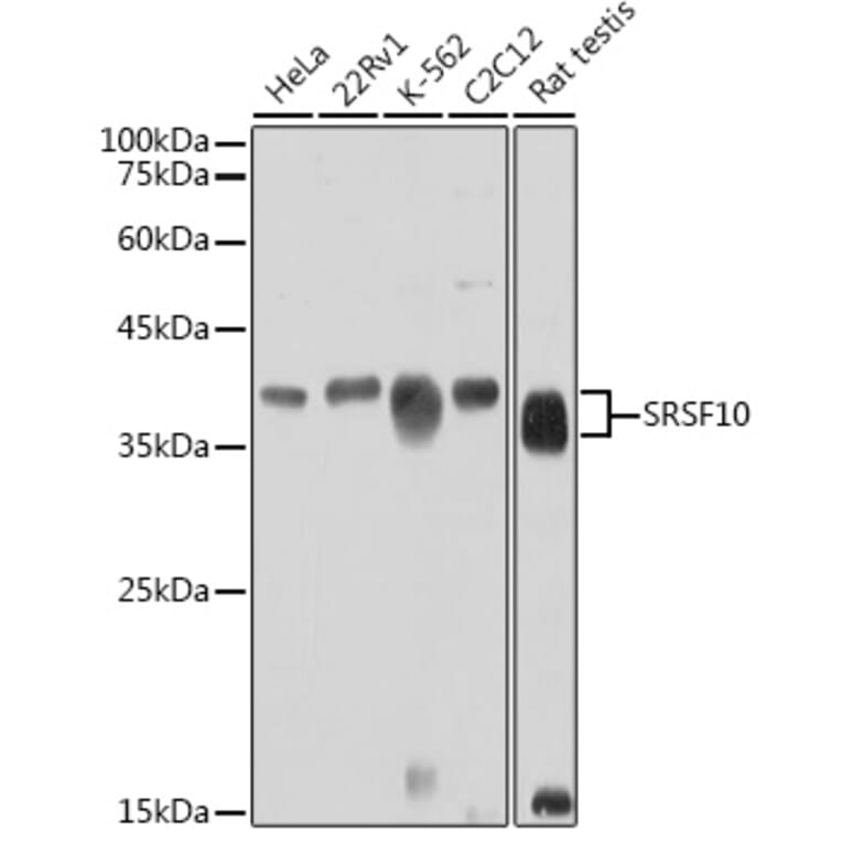 Western Blot - Anti-SRSF10 Antibody (A305632) - Antibodies.com