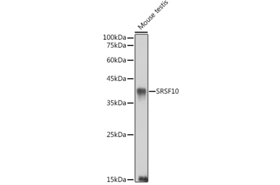 Western Blot - Anti-SRSF10 Antibody (A305632) - Antibodies.com
