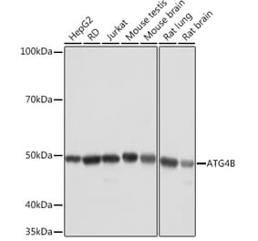 Western Blot - Anti-ATG4B Antibody [ARC1264] (A305633) - Antibodies.com