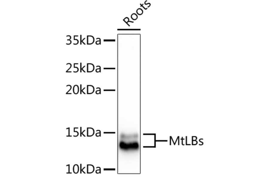 Western Blot - Anti-LB1 + LB2 Antibody (A305634) - Antibodies.com