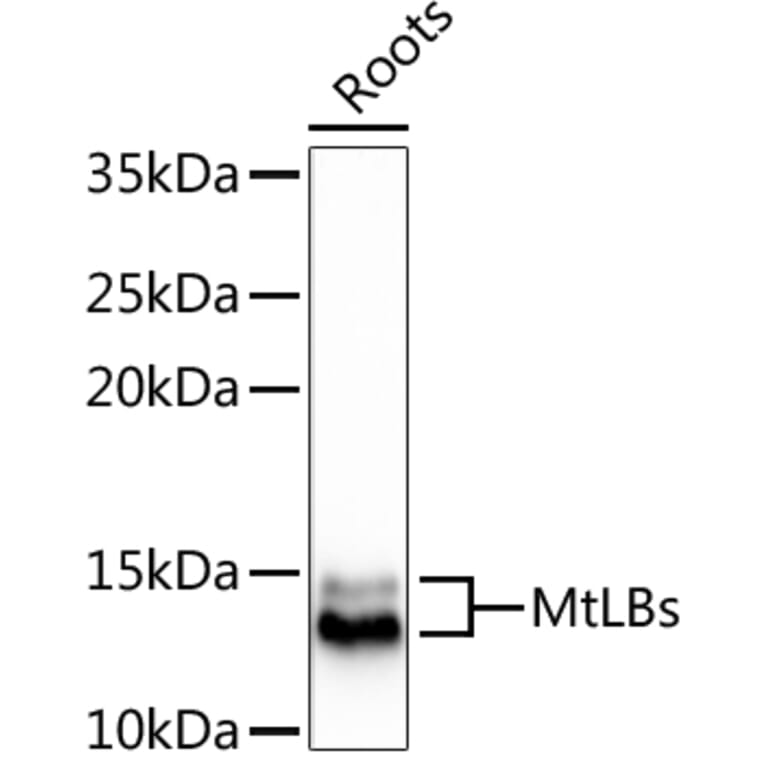Western Blot - Anti-LB1 + LB2 Antibody (A305634) - Antibodies.com