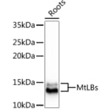 Western Blot - Anti-LB1 + LB2 Antibody (A305634) - Antibodies.com
