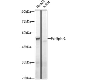 Western Blot - Anti-ADFP Antibody [ARC51735] (A305635) - Antibodies.com