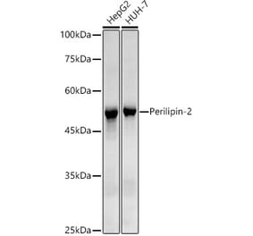 Western Blot - Anti-ADFP Antibody [ARC51733] (A305636) - Antibodies.com