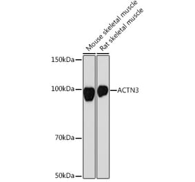 Western Blot - Anti-ACTN3 Antibody [ARC2202] (A305637) - Antibodies.com
