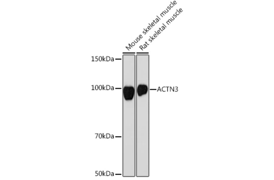 Western Blot - Anti-ACTN3 Antibody [ARC2202] (A305637) - Antibodies.com