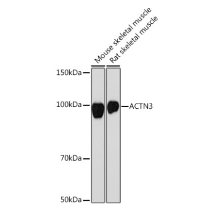 Western Blot - Anti-ACTN3 Antibody [ARC2202] (A305637) - Antibodies.com