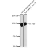 Western Blot - Anti-ACTN3 Antibody [ARC2202] (A305637) - Antibodies.com