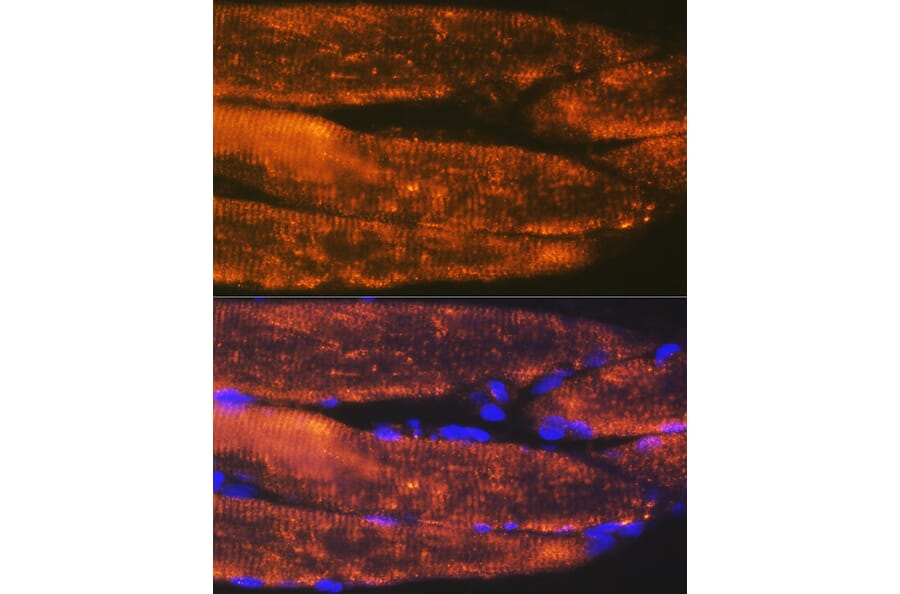 Immunofluorescence - Anti-ACTN3 Antibody [ARC2202] (A305637) - Antibodies.com