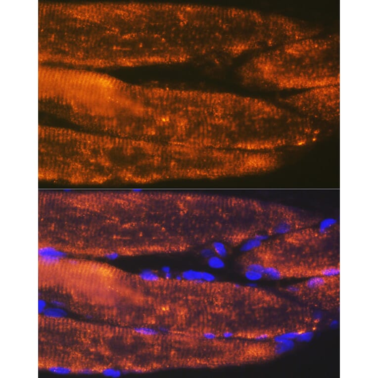 Immunofluorescence - Anti-ACTN3 Antibody [ARC2202] (A305637) - Antibodies.com