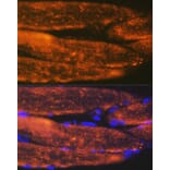 Immunofluorescence - Anti-ACTN3 Antibody [ARC2202] (A305637) - Antibodies.com