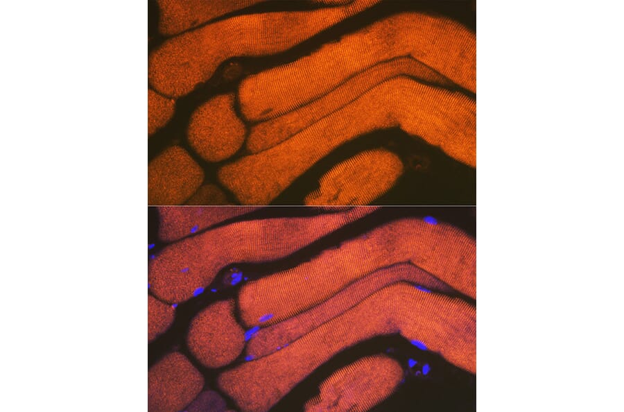Immunofluorescence - Anti-ACTN3 Antibody [ARC2202] (A305637) - Antibodies.com