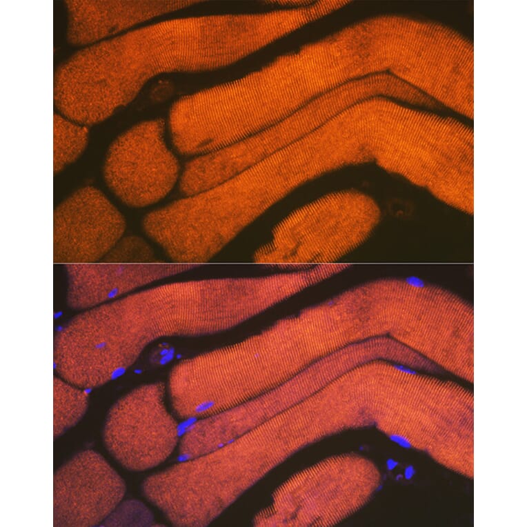 Immunofluorescence - Anti-ACTN3 Antibody [ARC2202] (A305637) - Antibodies.com