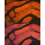 Immunofluorescence - Anti-ACTN3 Antibody [ARC2202] (A305637) - Antibodies.com