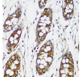 Immunohistochemistry - Anti-FNDC4 Antibody (A305638) - Antibodies.com