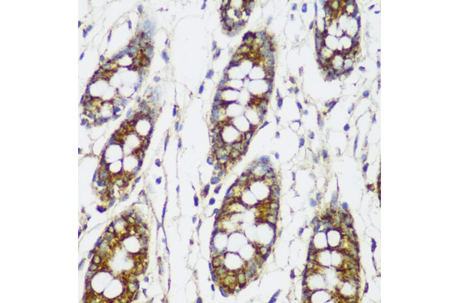 Immunohistochemistry - Anti-FNDC4 Antibody (A305638) - Antibodies.com