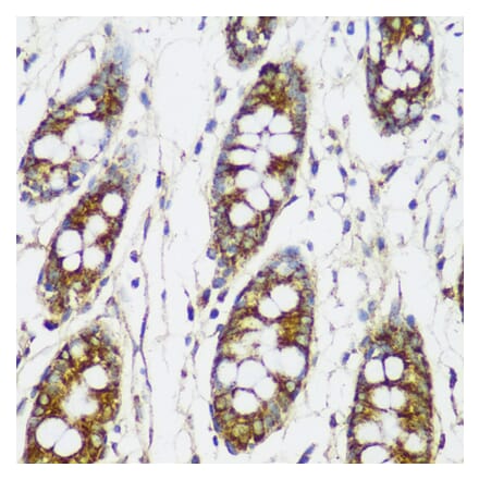 Immunohistochemistry - Anti-FNDC4 Antibody (A305638) - Antibodies.com