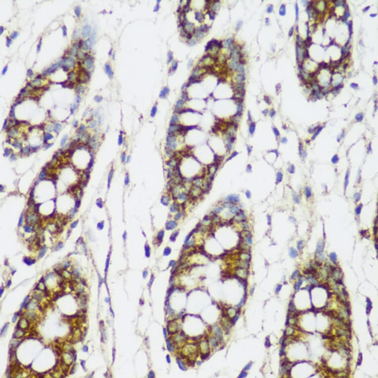 Immunohistochemistry - Anti-FNDC4 Antibody (A305638) - Antibodies.com