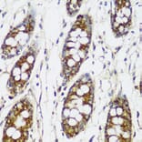 Immunohistochemistry - Anti-FNDC4 Antibody (A305638) - Antibodies.com
