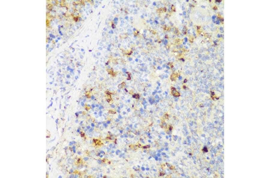 Immunohistochemistry - Anti-FNDC4 Antibody (A305638) - Antibodies.com