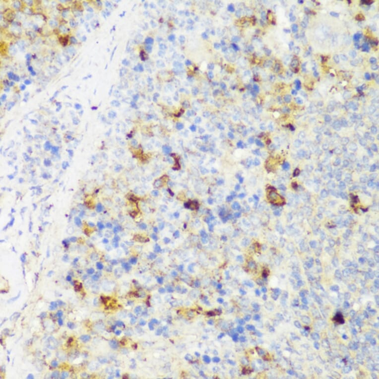 Immunohistochemistry - Anti-FNDC4 Antibody (A305638) - Antibodies.com
