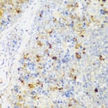 Immunohistochemistry - Anti-FNDC4 Antibody (A305638) - Antibodies.com