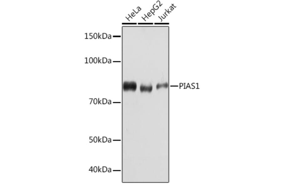 Western Blot - Anti-PIAS1 Antibody [ARC1116] (A305639) - Antibodies.com