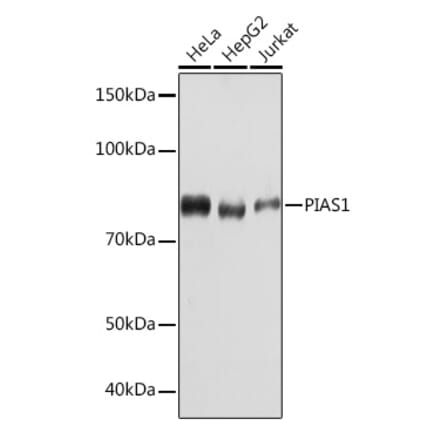 Western Blot - Anti-PIAS1 Antibody [ARC1116] (A305639) - Antibodies.com