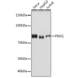 Western Blot - Anti-PIAS1 Antibody [ARC1116] (A305639) - Antibodies.com