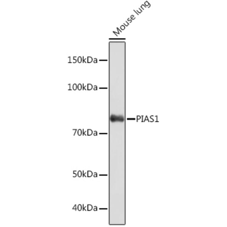 Western Blot - Anti-PIAS1 Antibody [ARC1116] (A305639) - Antibodies.com