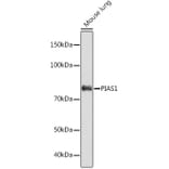 Western Blot - Anti-PIAS1 Antibody [ARC1116] (A305639) - Antibodies.com