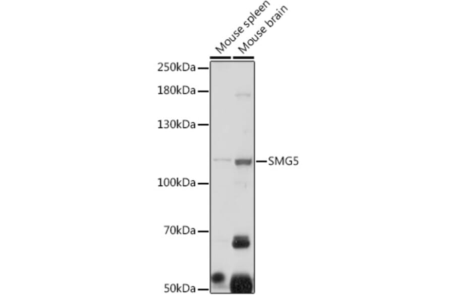Western Blot - Anti-SMG5 Antibody (A305640) - Antibodies.com