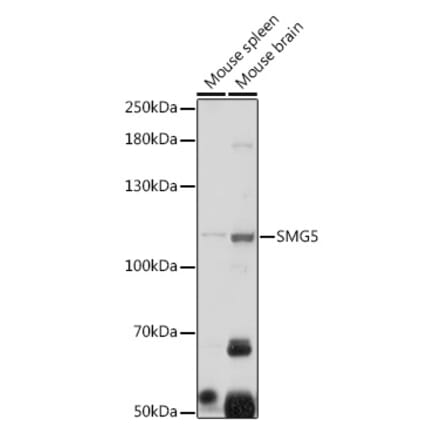 Western Blot - Anti-SMG5 Antibody (A305640) - Antibodies.com