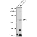 Western Blot - Anti-SMG5 Antibody (A305640) - Antibodies.com