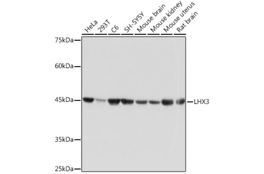 Western Blot - Anti-LHX3/LIM Antibody [ARC2150] (A305641) - Antibodies.com