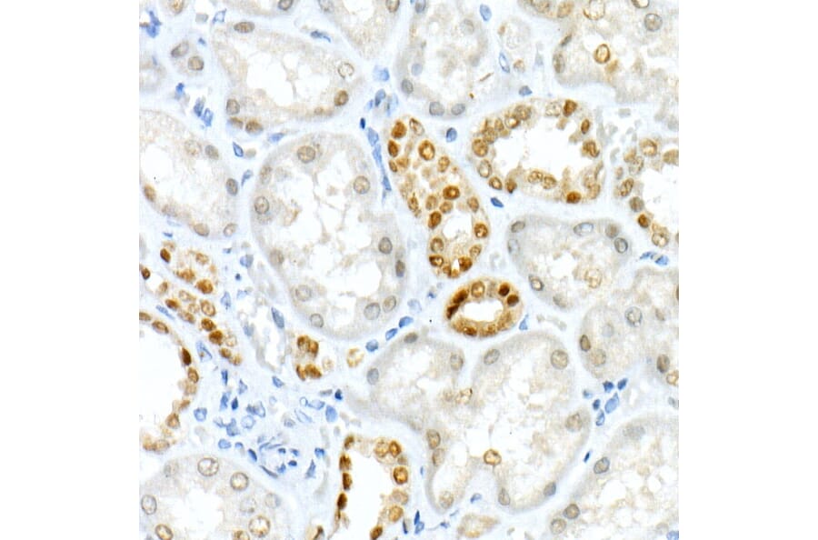 Immunohistochemistry - Anti-PAX8 Antibody [ARC55538] (A305642) - Antibodies.com