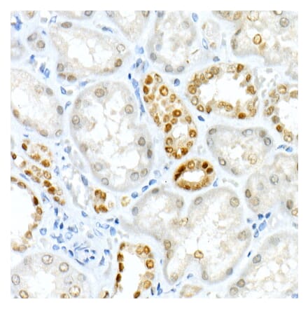 Immunohistochemistry - Anti-PAX8 Antibody [ARC55538] (A305642) - Antibodies.com