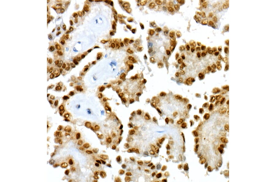 Immunohistochemistry - Anti-PAX8 Antibody [ARC55538] (A305642) - Antibodies.com
