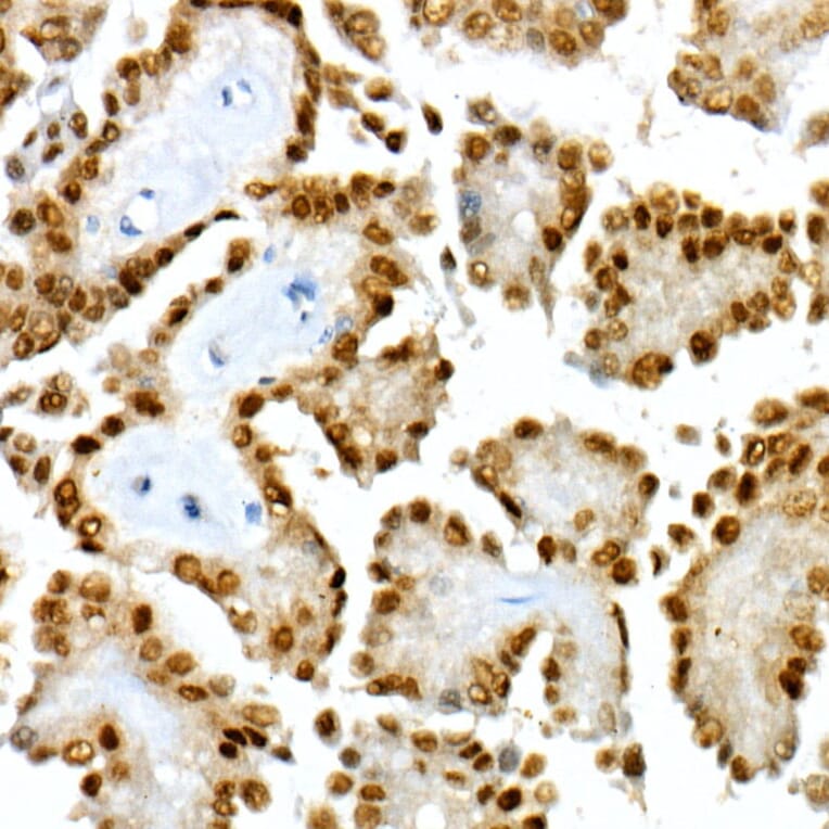Immunohistochemistry - Anti-PAX8 Antibody [ARC55538] (A305642) - Antibodies.com