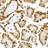 Immunohistochemistry - Anti-PAX8 Antibody [ARC55538] (A305642) - Antibodies.com