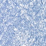 Immunohistochemistry - Anti-PAX8 Antibody [ARC55538] (A305642) - Antibodies.com