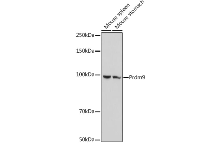 Western Blot - Anti-Prdm9 Antibody (A305644) - Antibodies.com