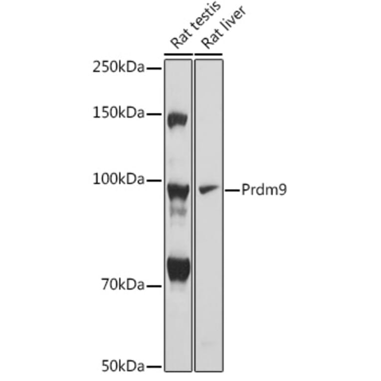 Western Blot - Anti-Prdm9 Antibody (A305644) - Antibodies.com