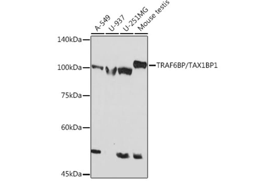 Western Blot - Anti-TRAF6BP/TAX1BP1 Antibody [ARC2184] (A305645) - Antibodies.com
