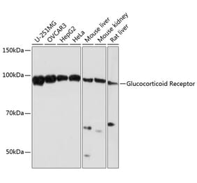 Western Blot - Anti-Glucocorticoid Receptor Antibody [ARC0062] (A305646) - Antibodies.com